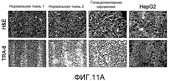 Комбинации антител, обладающих селективностью по отношению к рецептору лиганда, индуцирующему апоптоз, ассоциированный с фактором некроза опухоли, и других терапевтических средств (патент 2313368)