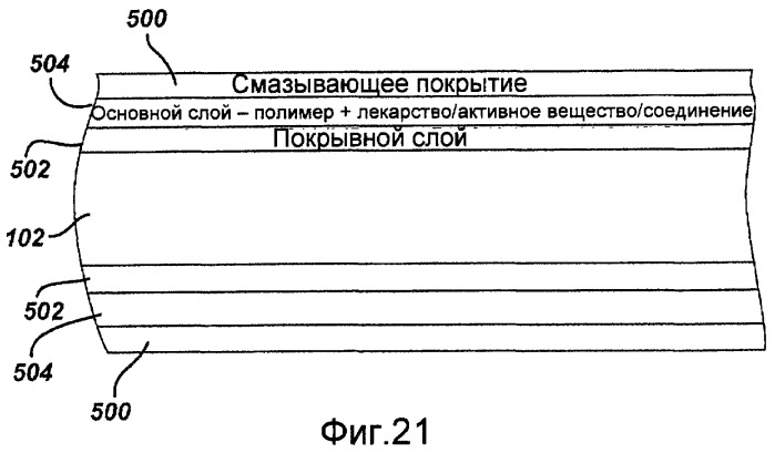 Локальная сосудистая доставка пробукола, одного или в комбинации с сиролимусом, для лечения рестеноза, уязвимых бляшек, ааа (аневризмы брюшной аорты) и инсульта (патент 2481084)