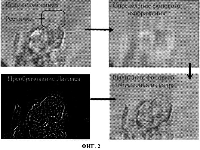 Способ выбора тактики лечения хронического и острого риносинусита (патент 2254805)