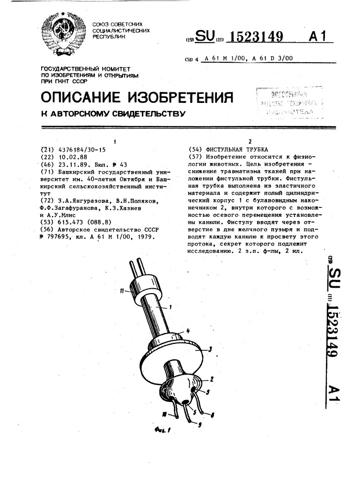 Фистульная трубка (патент 1523149)