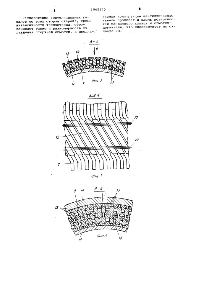 Устройство для крепления лобовой части обмотки ротора (патент 1065970)