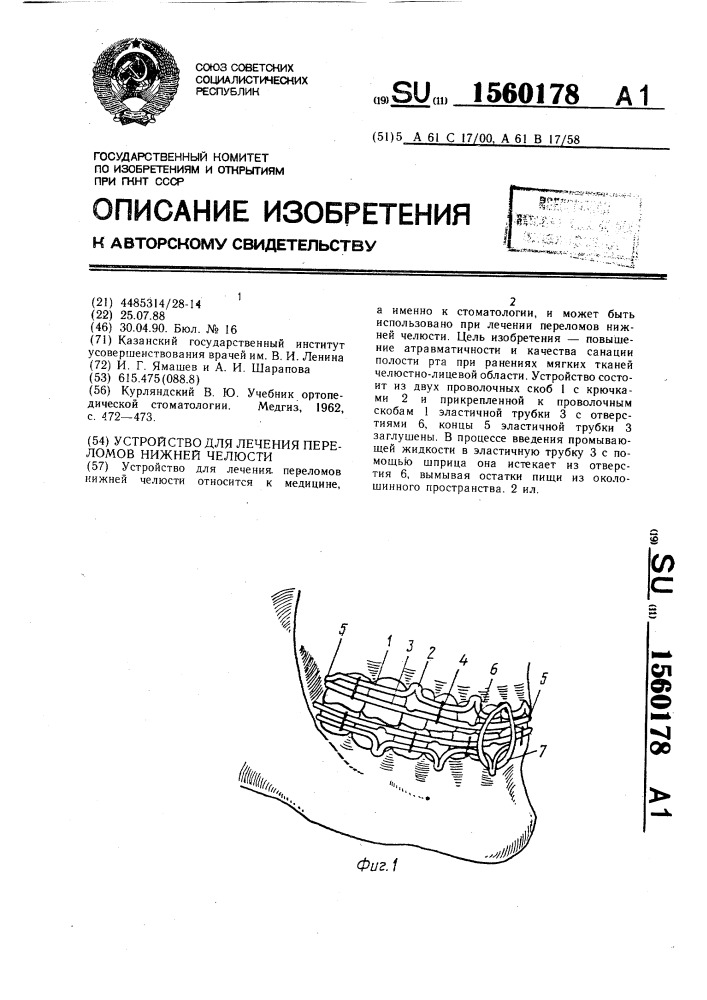 Устройство для лечения переломов нижней челюсти (патент 1560178)
