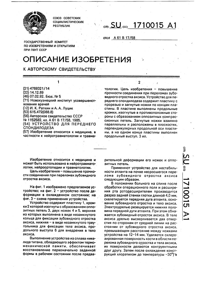 Устройство для переднего спондилодеза (патент 1710015)