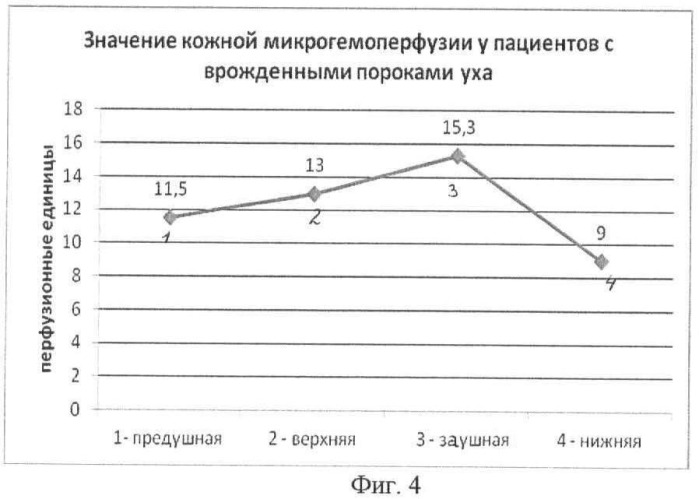 Способ определения кожной микроциркуляции в околоушной области у больных с врожденными пороками уха и приобретенными деформациями ушной раковины (патент 2462994)