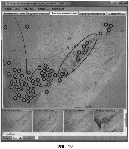 Автоматизированная система реконструкции 3d распределения нейронов по серии изображений срезов головного мозга (патент 2504012)
