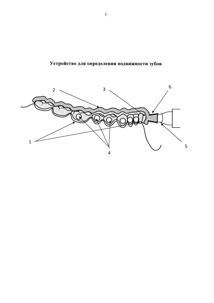 Устройство для определения подвижности зубов (патент 2626372)