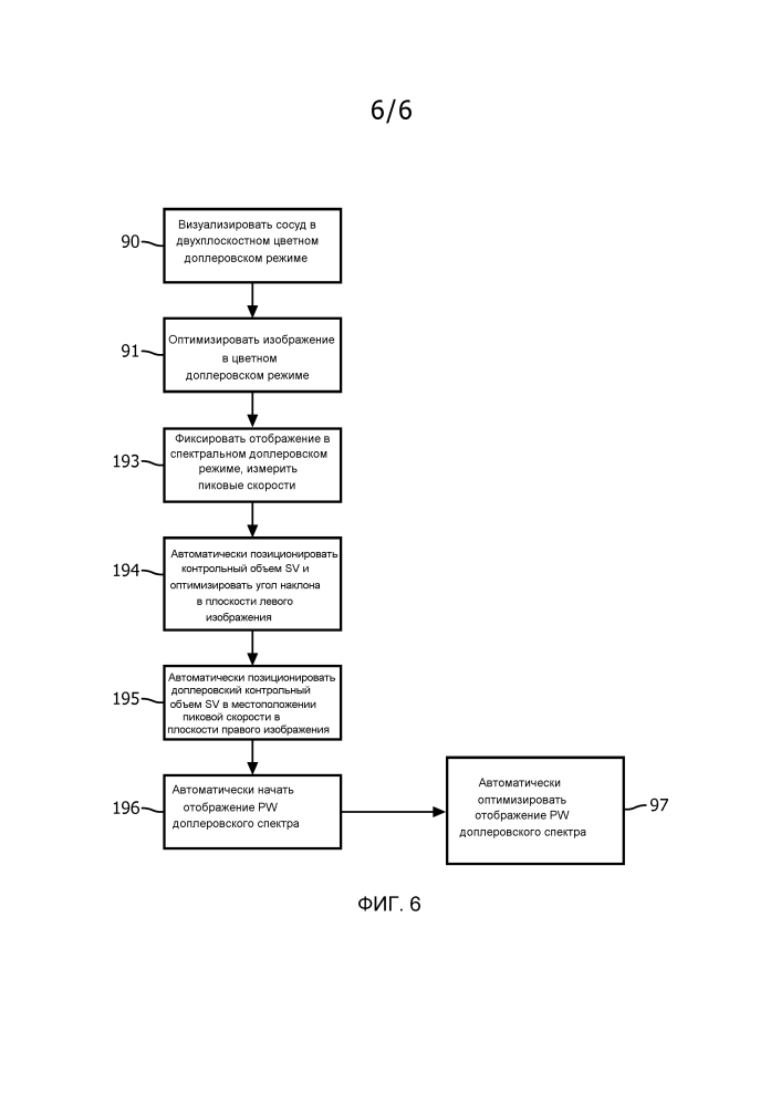Автоматизированная последовательность операций в двухплоскостном режиме pw для ультразвуковой оценки стеноза (патент 2633915)