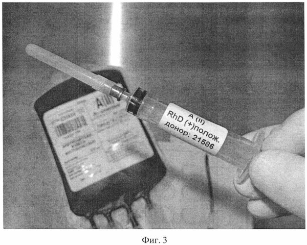 Способ отбора образца донорской крови и (или) ее компонентов (патент 2569603)