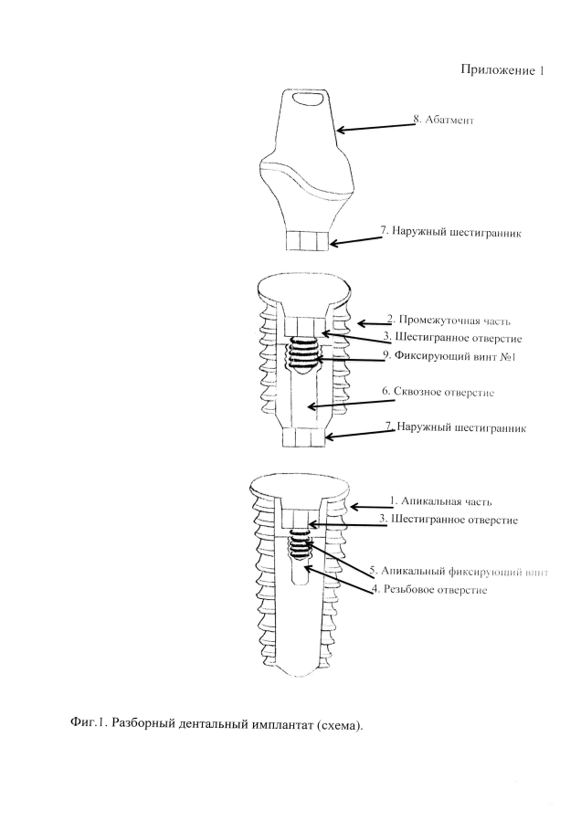 Разборный дентальный имплантат (патент 2593349)