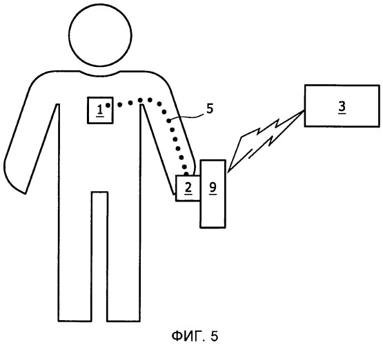 Беспроводное наблюдение за пациентом с использованием потоковой передачи медицинских данных с помощью связанного с телом соединения (патент 2490799)