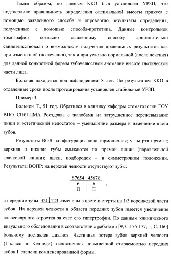 Способ определения оптимальной высоты прикуса (патент 2354300)