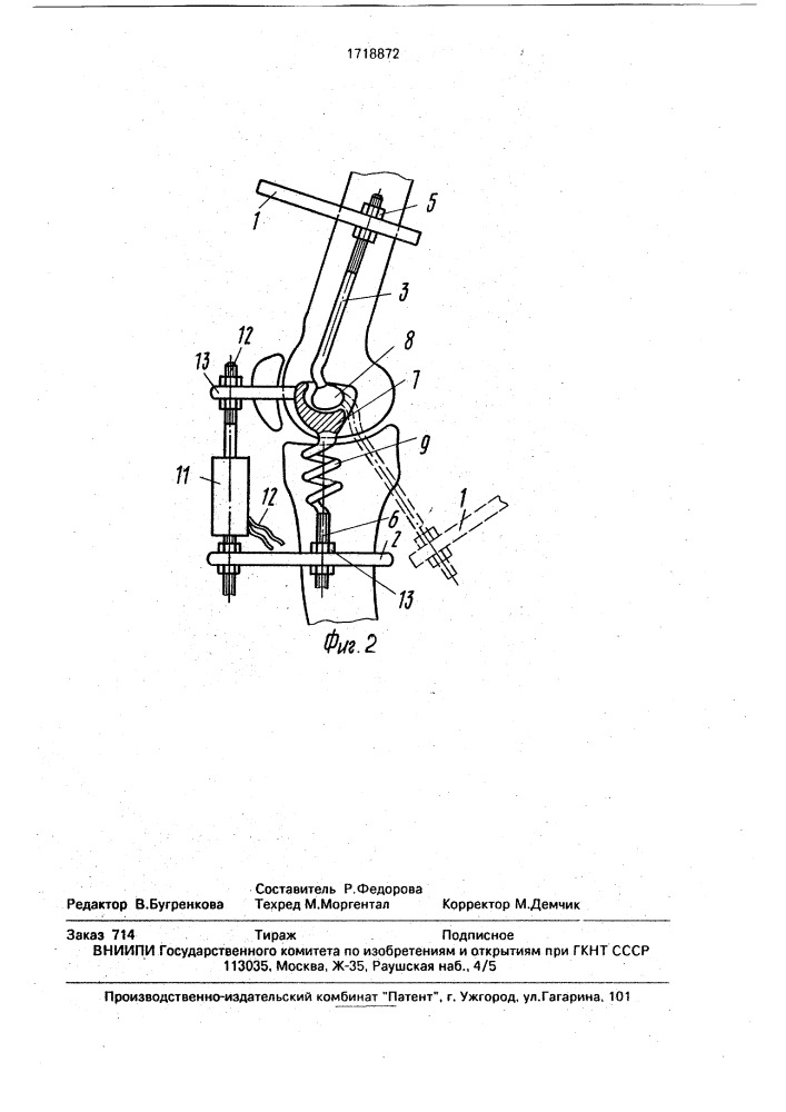 Аппарат для лечения контрактуры коленного сустава (патент 1718872)
