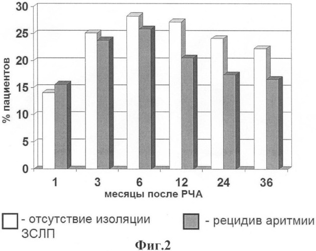 Способ оценки эффективности изоляции задней стенки левого предсердия (патент 2387364)