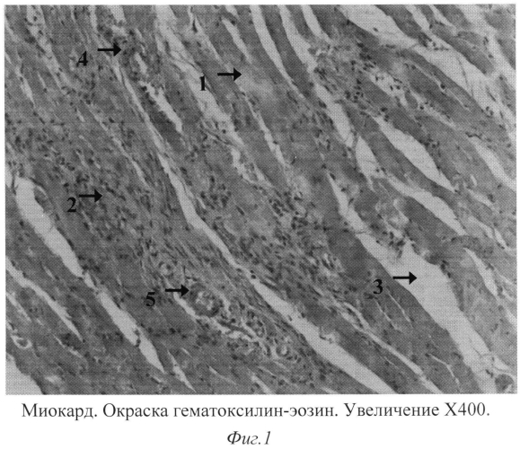 Способ моделирования экспериментальной амилоидной кардиопатии у крыс (патент 2556571)