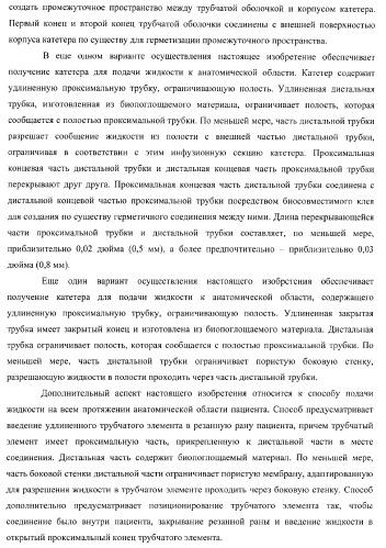 Катетер для равномерной подачи лекарственного средства (патент 2366465)