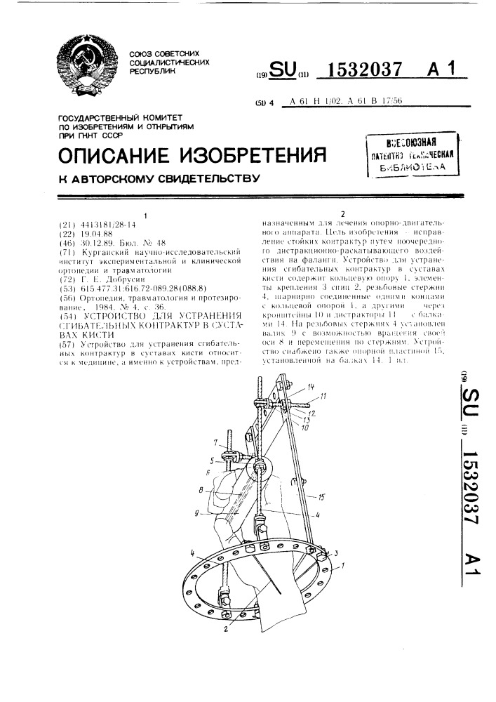 Устройство для устранения сгибательных контрактур в суставах кисти (патент 1532037)