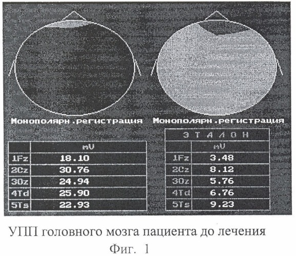 Фармацевтическая композиция, включающая холина альфосцерат и гопантеновую кислоту (или ее соль), для лечения недостаточности кровообращения мозга и эректильной дисфункции (патент 2391095)