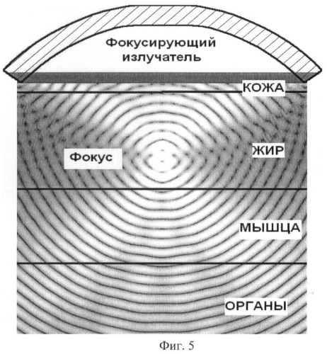 Способ комплексной косметической обработки поверхностных тканей пациента и устройство для его осуществления (патент 2413492)