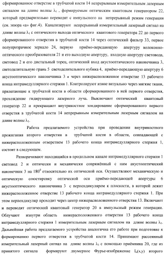 Способ дистального блокирования интрамедуллярных стержней при остеосинтезе длинных трубчатых костей и устройство для его осуществления (патент 2387401)