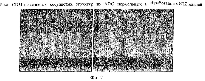 Применение композиции, состоящей из концентрированной клеточной популяции, представляющей собой стволовые клетки и недифференцированные клетки-предшественники (патент 2372924)