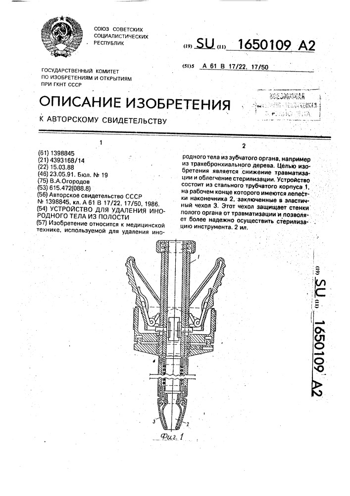 Устройство для удаления инородного тела из полости (патент 1650109)