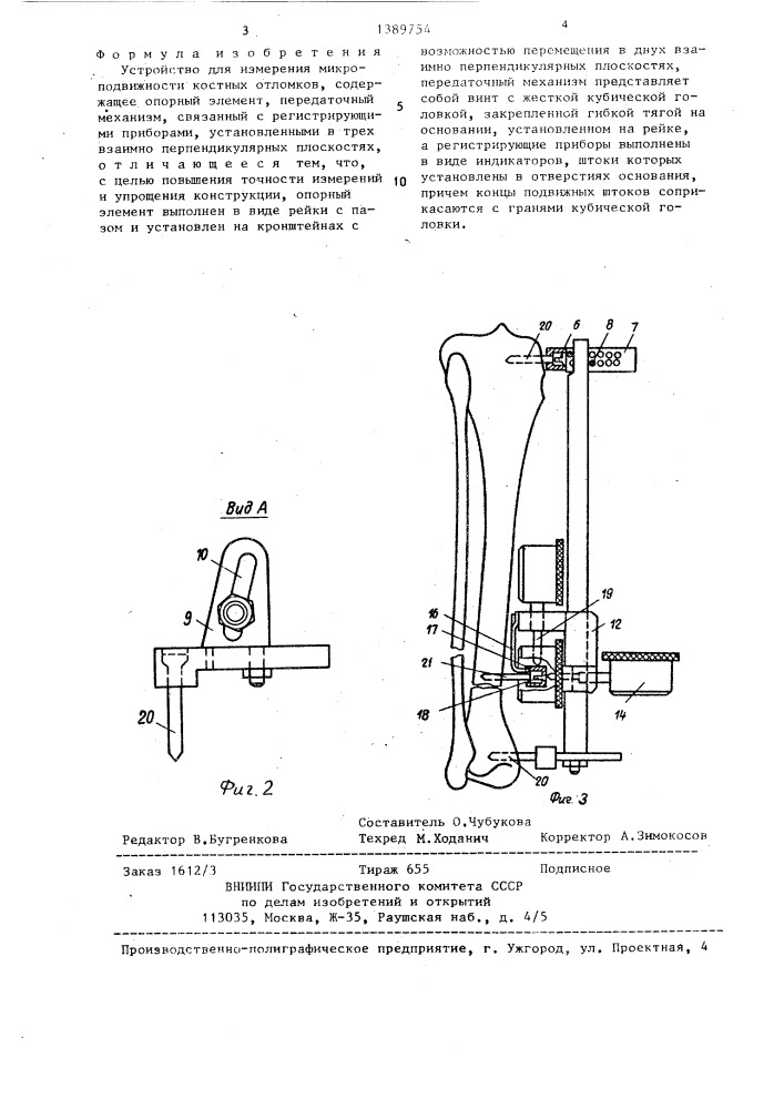 Устройство для измерения микроподвижности костных отломков (патент 1389754)