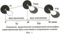 Способ диагностики нарушений уродинамики расширенной лоханки у детей с гидронефрозом Способ диагностики нарушений уродинамики расширенной лоханки у детей с гидронефрозом
