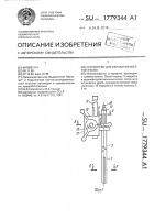 Устройство для обработки костной ткани Устройство для обработки костной ткани