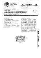 Способ лечения околососочкового дивертикула Способ лечения околососочкового дивертикула