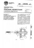 Устройство для фиксации костных фрагментов Устройство для фиксации костных фрагментов
