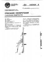 Фиксатор позвоночника Фиксатор позвоночника