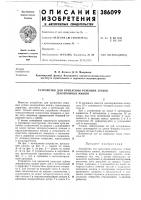 Устройство для крепления режущих зубьев землеройных машин Устройство для крепления режущих зубьев землеройных машин