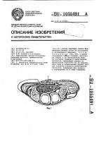 Способ пластики связки карпального канала Способ пластики связки карпального канала