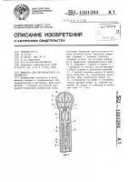 Фиксатор для внутрикостного остеосинтеза Фиксатор для внутрикостного остеосинтеза