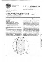 Акустический элемент ограждения Акустический элемент ограждения