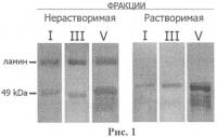 Способ профилактики и лечения осложнений сахарного диабета, связанных с развитием дегенеративных процессов в нервной ткани, фармацевтическая композиция для нейропротективной терапии таких осложнений и способ ее получения Способ профилактики и лечения осложнений сахарного диабета, связанных с развитием дегенеративных процессов в нервной ткани, фармацевтическая композиция для нейропротективной терапии таких осложнений и способ ее получения