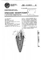 Искусственный зуб Искусственный зуб