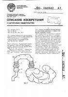 Способ установки постзаслоночного анастомоза кишечника у свиней при оценке кормового белка Способ установки постзаслоночного анастомоза кишечника у свиней при оценке кормового белка