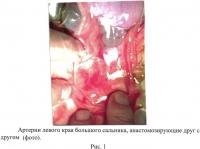 Способ хирургического лечения цирроза печени в эксперименте Способ хирургического лечения цирроза печени в эксперименте