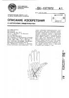 Способ лечения функциональных нарушений кисти Способ лечения функциональных нарушений кисти