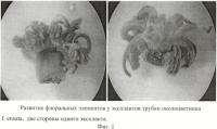 Способ получения растений-регенерантов ириса мечевидного (i. ensata thunb.) in vitro Способ получения растений-регенерантов ириса мечевидного (i. ensata thunb.) in vitro