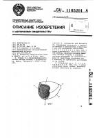 Устройство для фонофореза Устройство для фонофореза