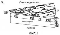 Изолированные популяции миелоидоподобных клеток костного мозга и способы лечения с ними Изолированные популяции миелоидоподобных клеток костного мозга и способы лечения с ними