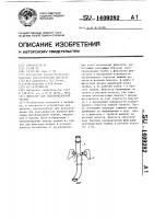 Фиксатор для эндотрахеальной трубки Фиксатор для эндотрахеальной трубки