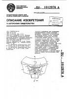 Устройство для стопорения регулировочного кольца конусной дробилки Устройство для стопорения регулировочного кольца конусной дробилки