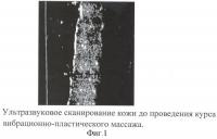 Способ коррекции инволюционных изменений кожи лица Способ коррекции инволюционных изменений кожи лица