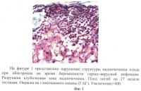 Способ оценки индуцирующего действия герпес-вирусной инфекции на активность формирования дегидроэпиандростеронсульфата и эстрадиола Способ оценки индуцирующего действия герпес-вирусной инфекции на активность формирования дегидроэпиандростеронсульфата и эстрадиола