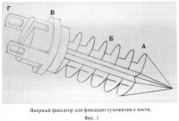 Способ и устройство для хирургической коррекции поперечной распластанности переднего отдела стопы Способ и устройство для хирургической коррекции поперечной распластанности переднего отдела стопы