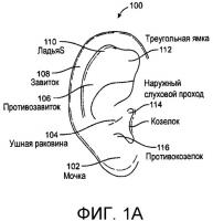 Системы и способы анестезирования ткани уха Системы и способы анестезирования ткани уха