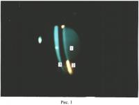 Способ экспериментального моделирования коркового вида катаракты in vivo Способ экспериментального моделирования коркового вида катаракты in vivo